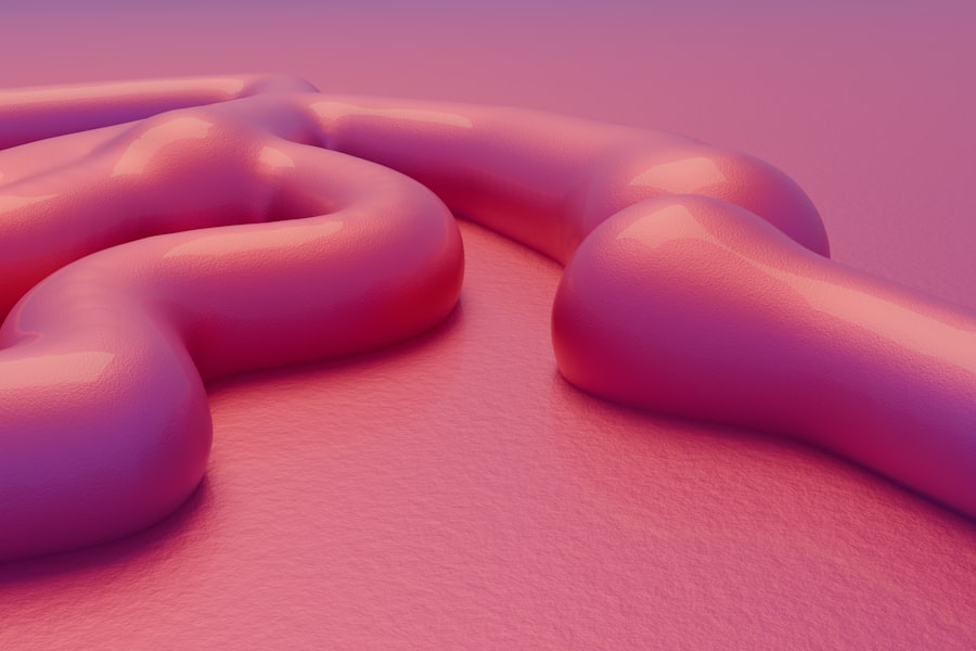 ulcerative colitis