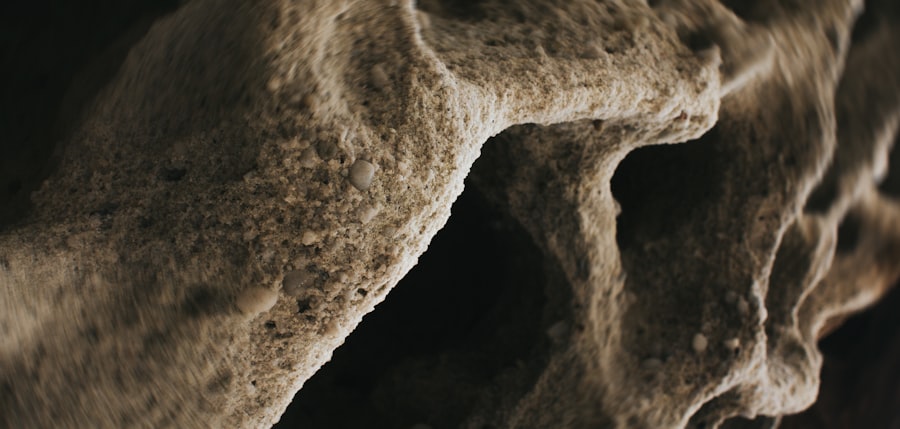osteoporosis