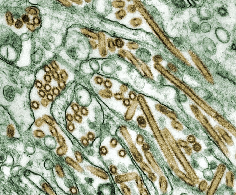 Photo influenza