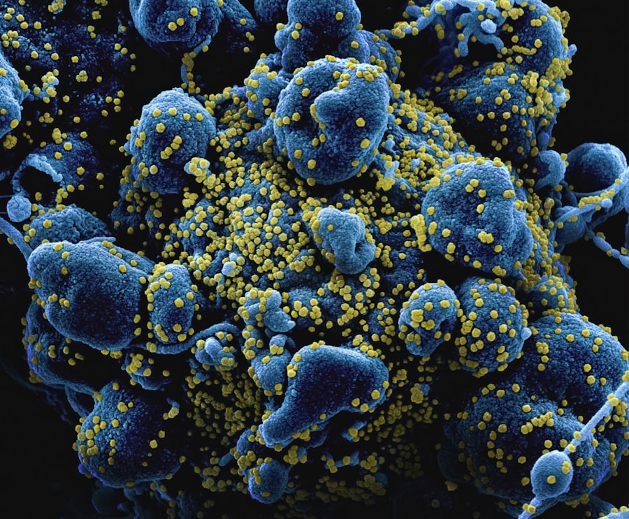 Photo hepatitis b
