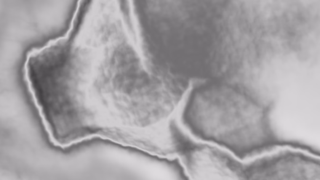 Preventing Osteoporosis: Building Strong Bones