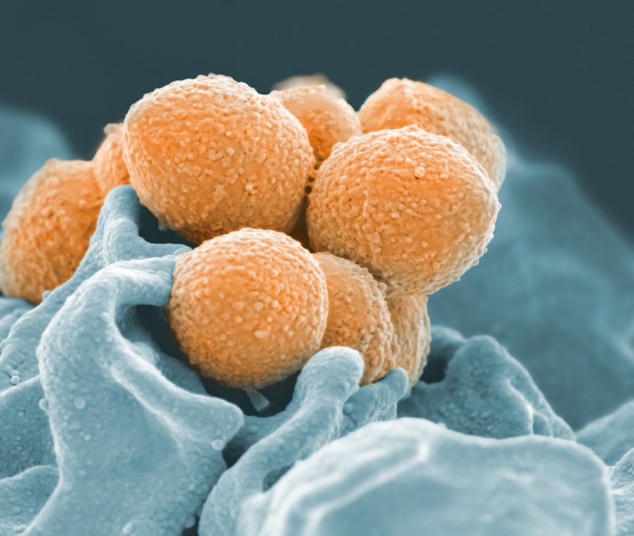 Photo yeast infection
