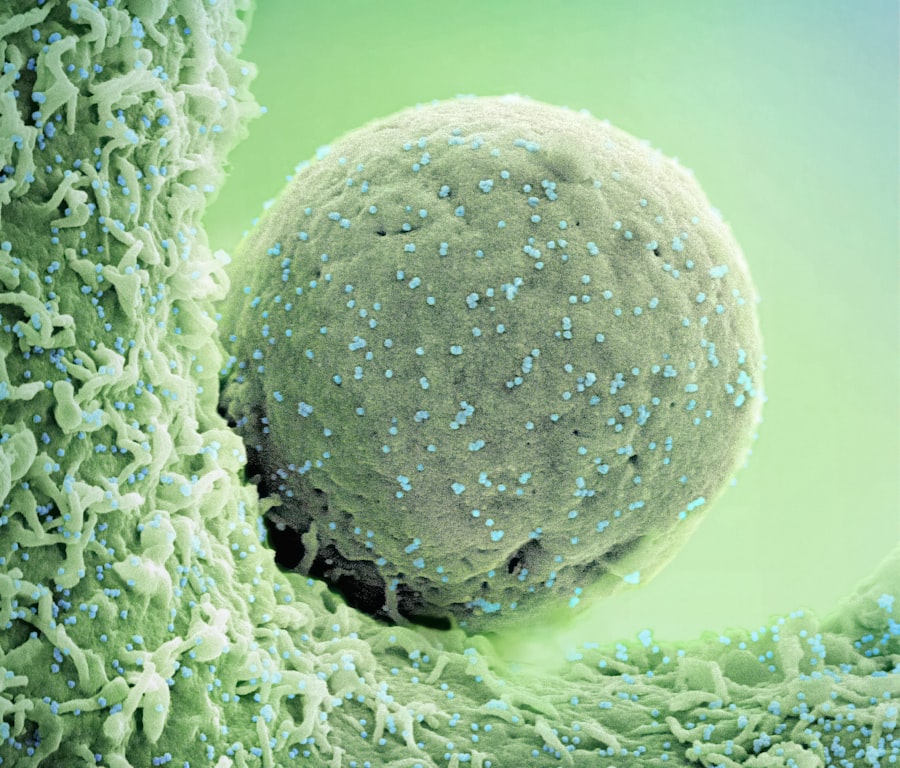 Photo yeast infection treatment