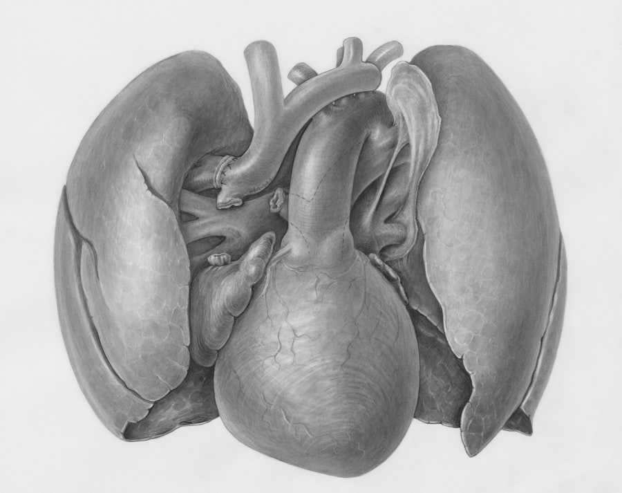 fatty liver disease